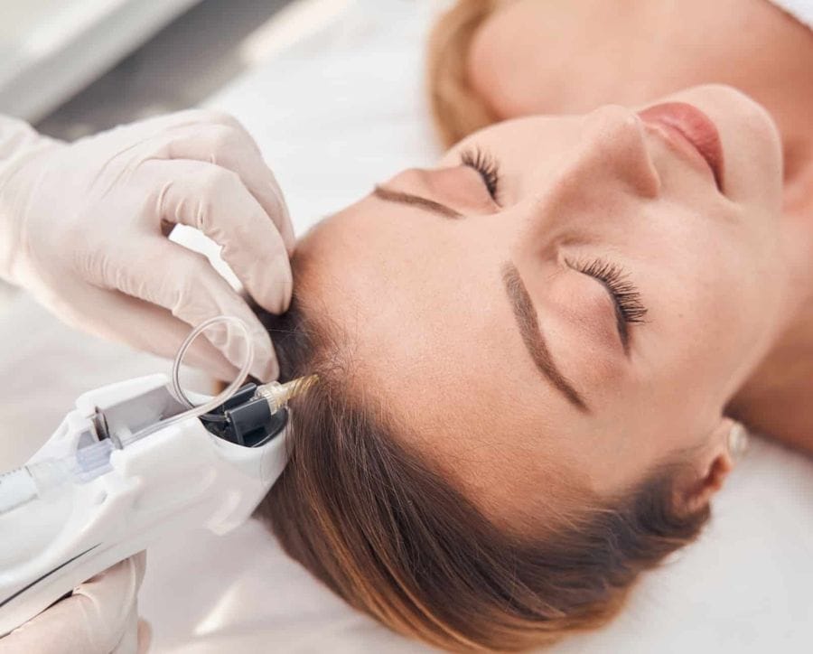 Mésothérapie Capillaire